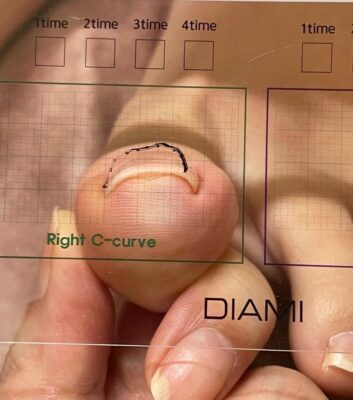 Curso Hey Switch Gel